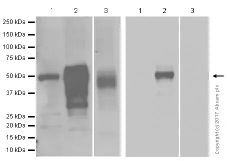 Anti-Wilms Tumor Protein antibody [CAN-R9(IHC)-56-2](AB89901)