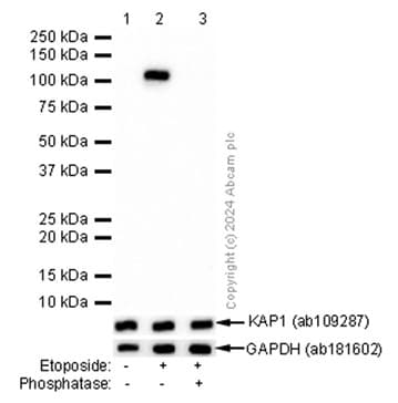 Kap1 Phospho S824 Antibody Epr5248 Bsa And Azide Free Ab215549  Western Blot Img436489