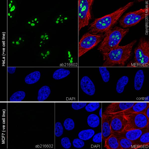 Anti-CDKN2A/p14ARF antibody [SP271] - BSA and Azide free(AB271999)