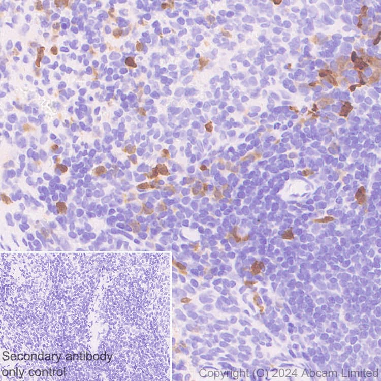 Anti-PADI2 / PAD2 antibody [EPR26940-85](ab322197)