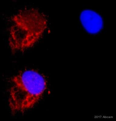 Anti-GRP78 BiP antibody(AB21685)