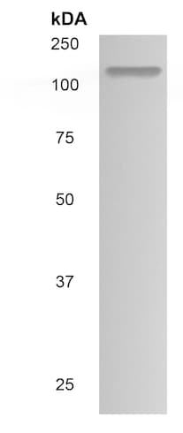 Anti-Thrombospondin 2 antibody [MM0568-9T19](ab89805)