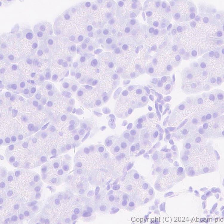 Anti-Adenovirus Type 5 Hexon antibody [EPR28237-57](AB316852)