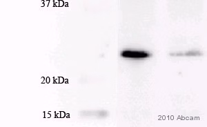 Rabbit Mouse Igg H L Hrp Ab6728 Western Blot Img43094