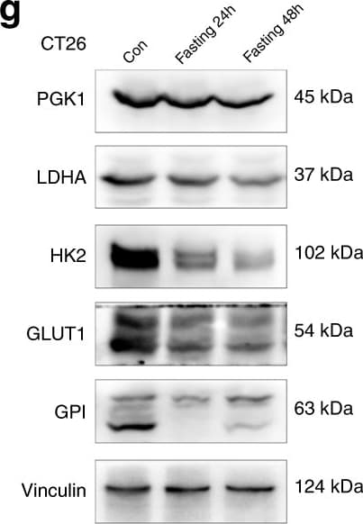 Amf Antibody 1b7d7 Ab66340  Western Blot Img442590