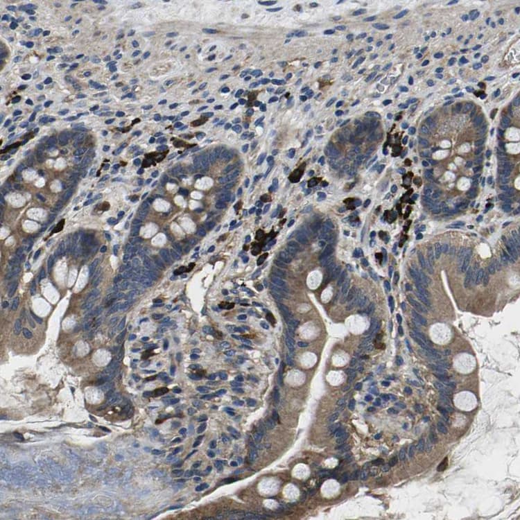 Plce1 Antibody Ab121476  Immunohistochemistry Formalin Pfa Fixed Paraffin Embedded Sections Img133070