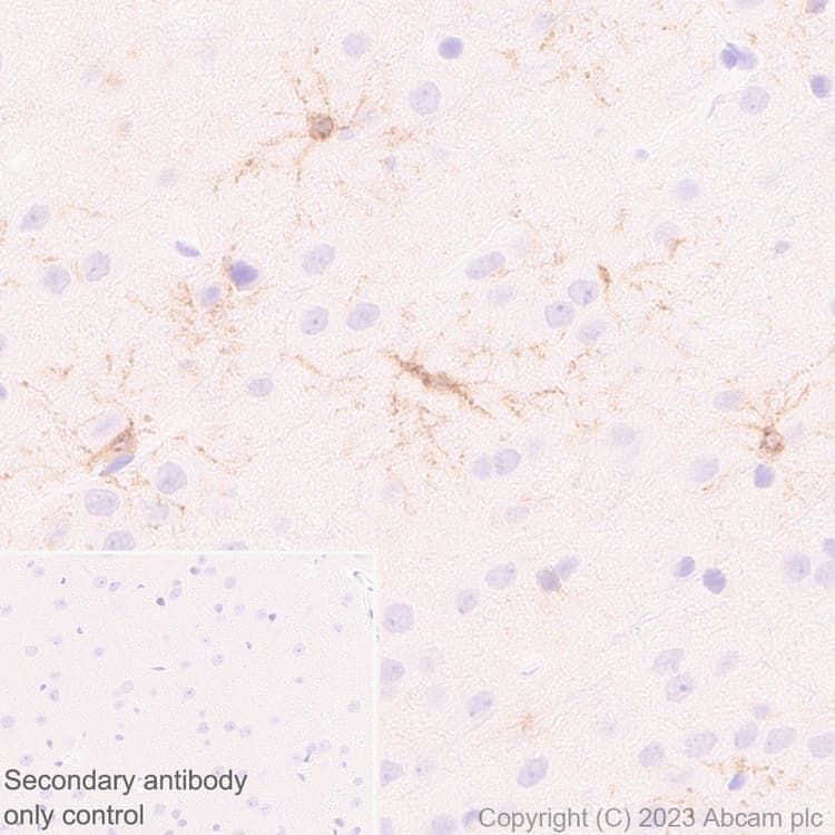 Anti-GPCR GPR17 antibody [EPR26423-34](AB316105)