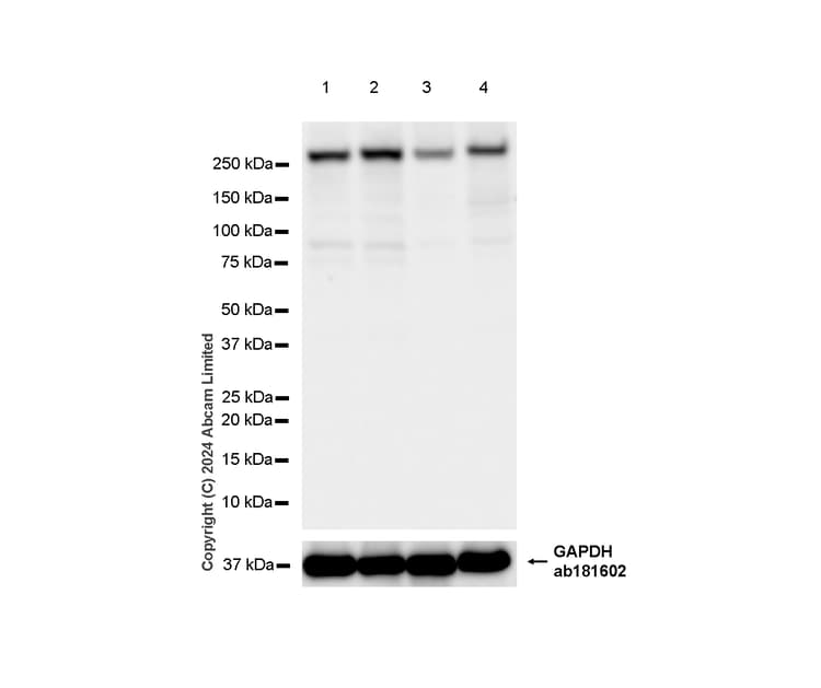 Mtor Antibody Rm1258 Ab322444  Western Blot Img438177