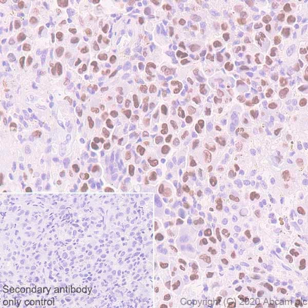 Anti-Histone H3 (mutated K36M) antibody [EPR23614-91] - BSA and Azide free(AB270796)