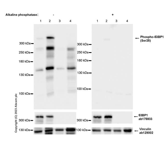 Anti-53BP1 antibody [EPR2172(2)](AB175933)