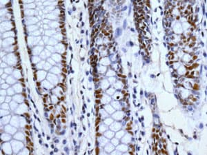 Anti-53BP1 antibody [EPR2172(2)](AB175933)