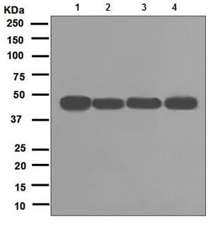 Rcc1 Antibody Epr5857 Bsa And Azide Free Ab226061  Western Blot Img111038