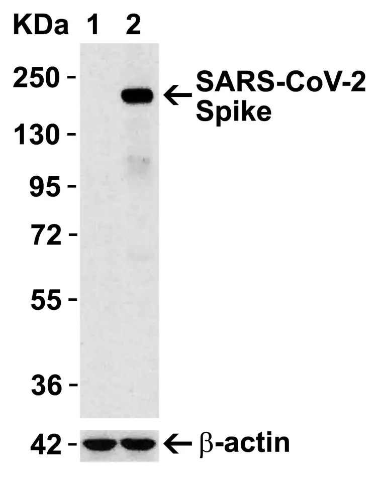 Anti-SARS-CoV-2 spike glycoprotein antibody - Coronavirus(AB272504)