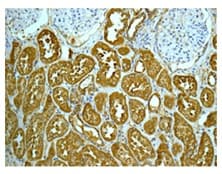 Superoxide Dismutase 3 Ec Sod Antibody Epr10860 Bsa And Azide Free Ab249643  Immunohistochemistry Formalin Pfa Fixed Paraffin Embedded Sections Img99935