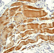 Anti-Sarcomeric Alpha Actinin antibody [EP2529Y](AB68167)
