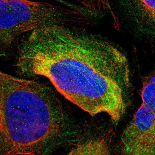 Tagln2 Antibody Ab121146  Immunocytochemistry Immunofluorescence Img108898