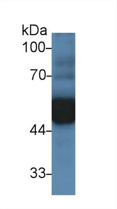 Anti-alpha 1 Antitrypsin antibody(AB231093)