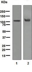 Anti-Androgen Receptor antibody [ER179(2)] - ChIP Grade(AB108341)