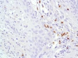 Anti-FOXP3 antibody [SP97](AB99963)