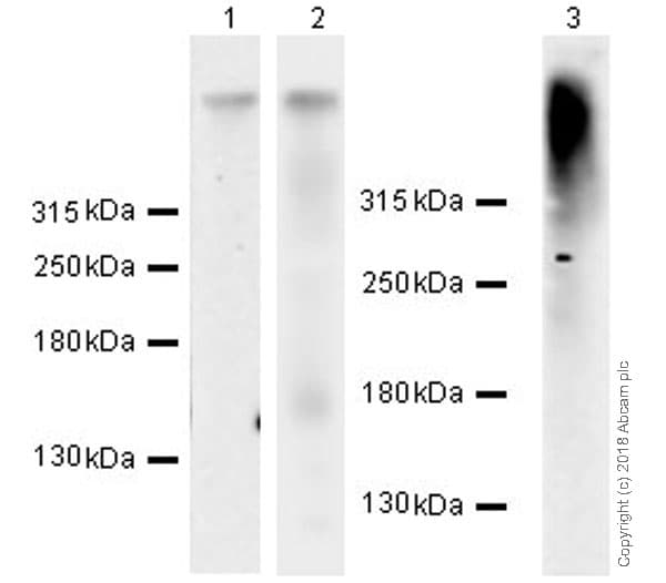 Anti-Ryanodine Receptor antibody [EPR21796](AB219798)