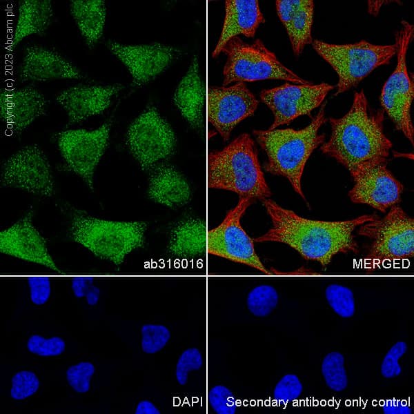 Anti-Aldose reductase antibody [EPR28780-7] - BSA and Azide free(AB316017)