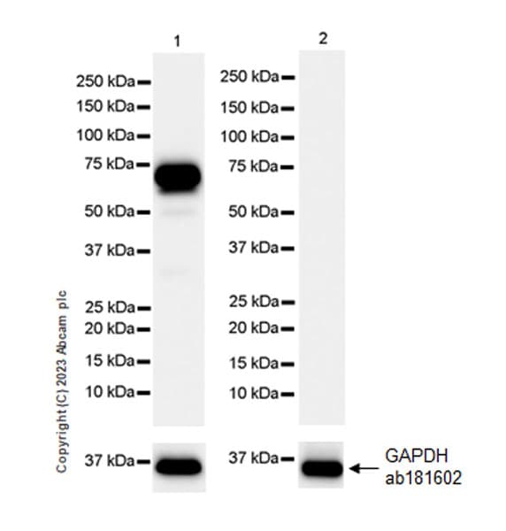 Smoc1 Antibody Epr26922 31 Ab313571  Western Blot Img418209