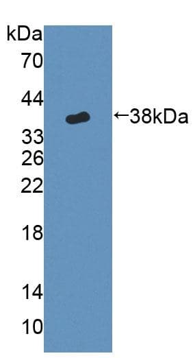 Anti-Cytochrome P450 17A1/CYP17A1 antibody(AB231914)