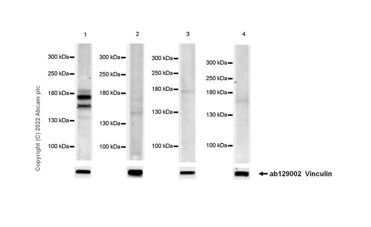 Anti-PRDM16 antibody [EPR24315-59](AB303534)