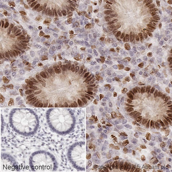 Streptavidin (HRP)(AB7403)