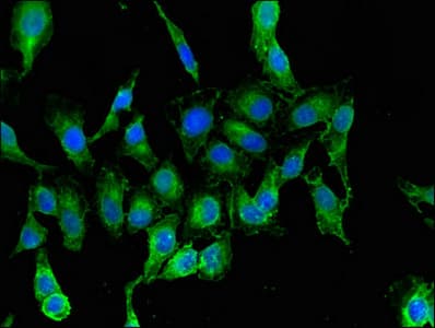Rars Antibody Ab236788  Immunocytochemistry Immunofluorescence Img32892