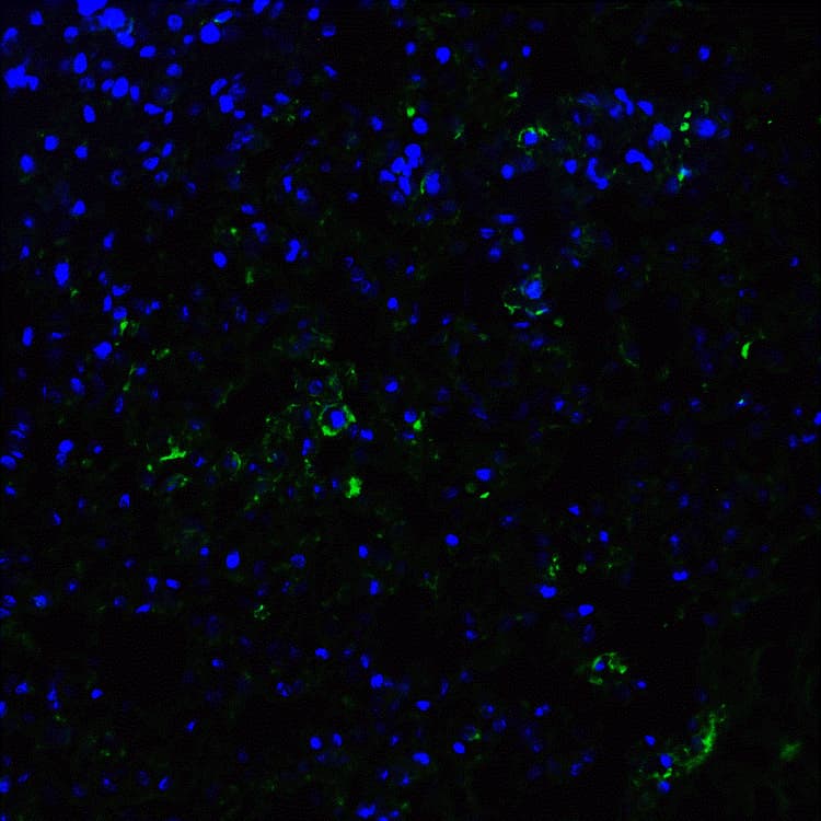 Anti-ACE2 antibody(AB15348)