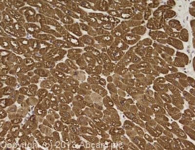 Cardiac Troponin I Antibody Mf4 Ab38210  Immunohistochemistry Formalin Pfa Fixed Paraffin Embedded Sections Img41585