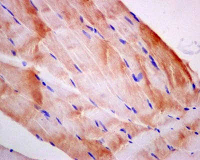 Anti-Filamin C antibody [EPR14498(B)] - BSA and Azide free(AB250273)