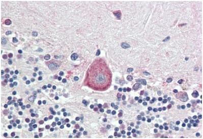 Hoxa10 Antibody Ab191470  Immunohistochemistry Formalin Pfa Fixed Paraffin Embedded Sections Img133999