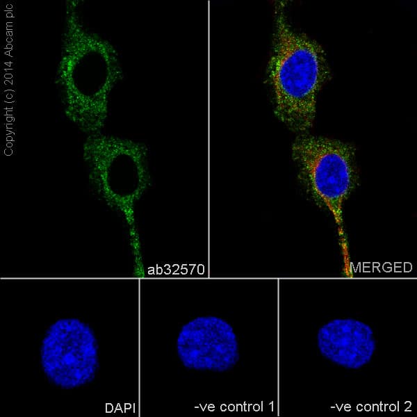 Anti-PDGFR alpha + PDGFR beta antibody [Y92] - C-terminal(AB32570)
