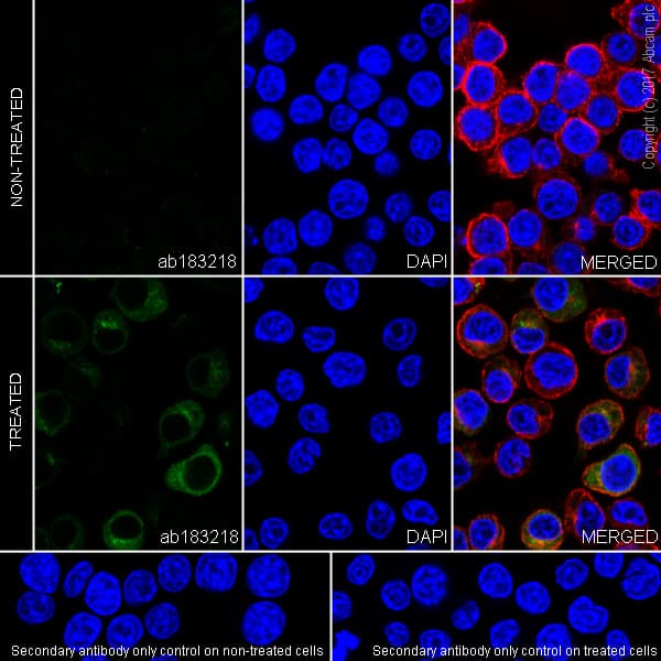 Anti-TNF alpha antibody [EPR19147](AB183218)