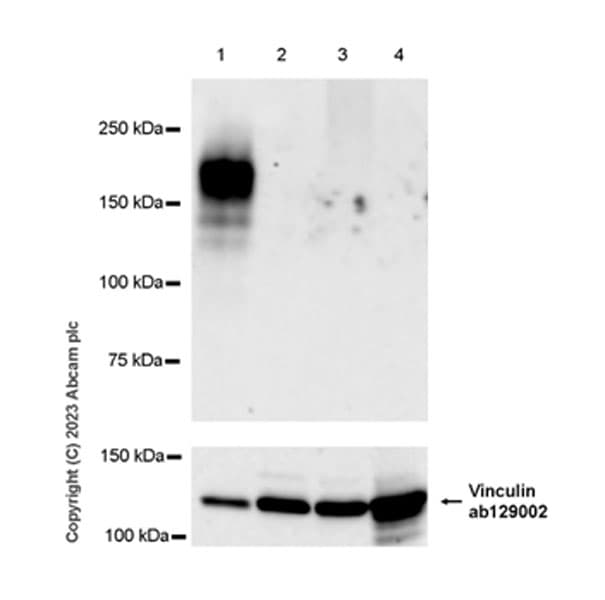 Anti-Sez6 antibody [EPR28518-55](AB314233)