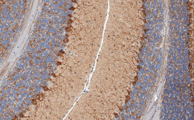 Mouse monoclonal [K-87] to GAD67/GAD1(ab26116)