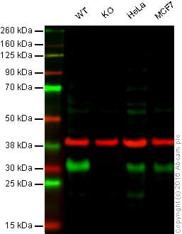 Anti-p27 KIP 1 antibody [EPFHCR16a](AB113075)