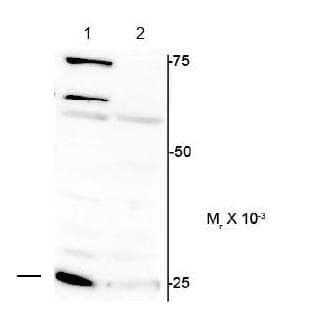 Anti-Cardiac Troponin I (phospho S150) antibody(AB169867)
