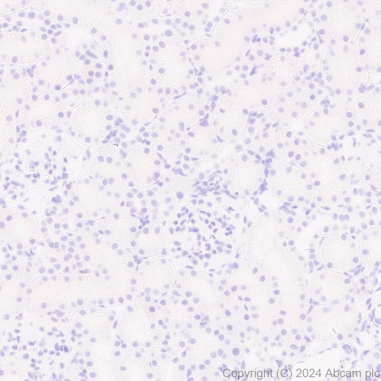 Anti-EBV Nuclear Antigen/EBNA1 antibody [EPR28706-78] - BSA and Azide free(AB316861)