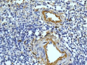 C9 Antibody Epr11232 82 Bsa And Azide Free Ab240175  Immunohistochemistry Formalin Pfa Fixed Paraffin Embedded Sections Img114531