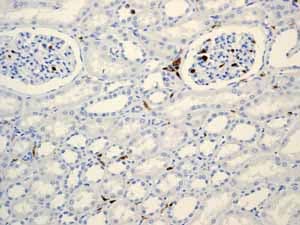 Anti-CD45 antibody [EP322Y](AB40763)