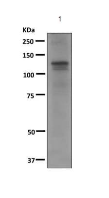 Anti-RAG1 antibody [EPRAGR1](AB172637)