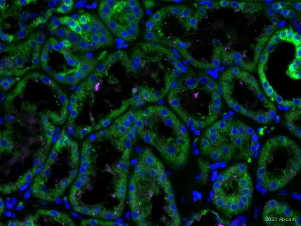 Goat Anti-Rabbit IgG H&L (Alexa Fluor® 555)(AB150078)