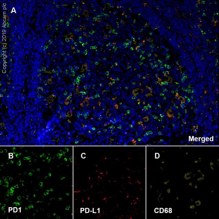 Macrophage Polarization Panel - Human IHC(ab278180)