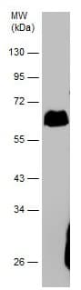 Anti-Tissue Plasminogen Activator antibody(AB227069)