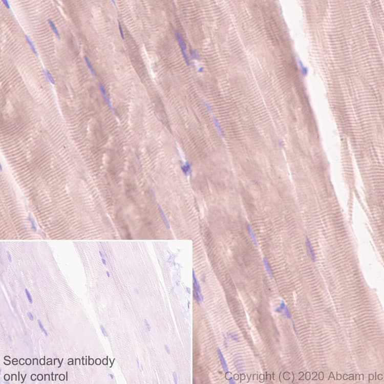 Anti-Calcium channel L type DHPR alpha 2 subunit/CACNA2D1 antibody [EPR23267-8] - BSA and Azide free(AB273881)