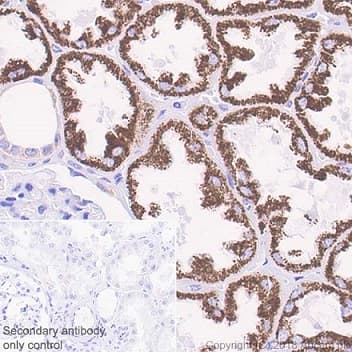Abat Gaba T Antibody Epr20842 Bsa And Azide Free Ab233702  Immunohistochemistry Formalin Pfa Fixed Paraffin Embedded Sections Img140125