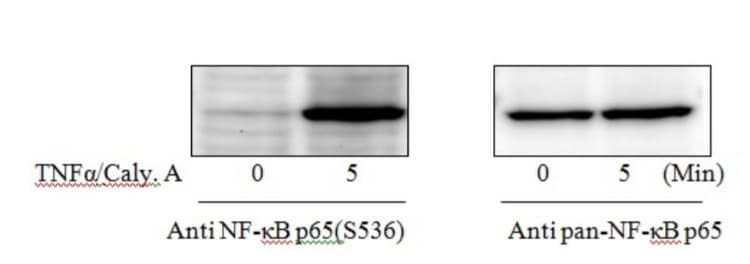 Phospho-NF-kB p65 (S536) and Total NF-kB p65 ELISA Kit(ab279874)
